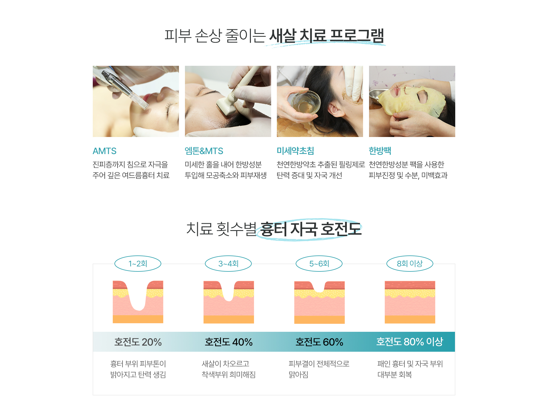 흉터,자국 치료